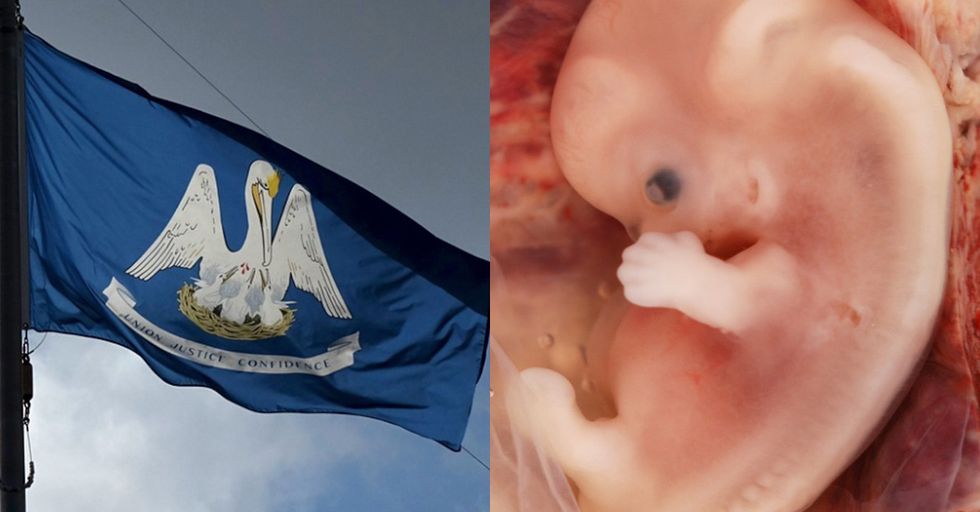 Louisiana Passes Ban on Abortion After 6 Weeks