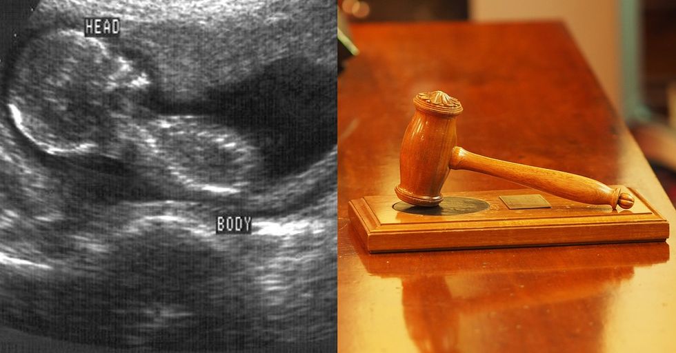 Newly Released Undercover Audio Features Discussion on How Unborn Babies Are Delivered Whole to Harvest Organs