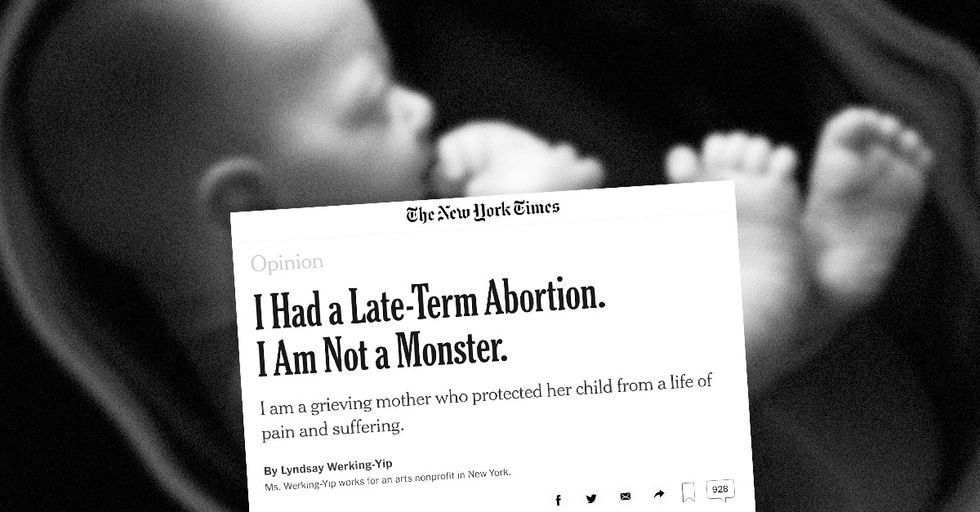 Opinion: Having an Abortion to 'Spare the Baby a Life of Suffering' is Cruel and Barbaric