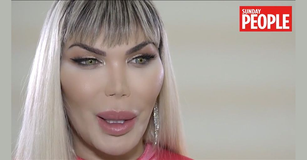 'Human Ken Doll' Comes Out as Transwoman, Insults Women with Female Stereotypes
