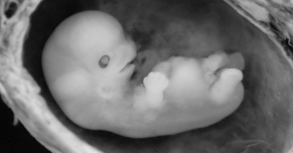 OPINION: You Cannot be Pro-Science AND Pro-Abortion