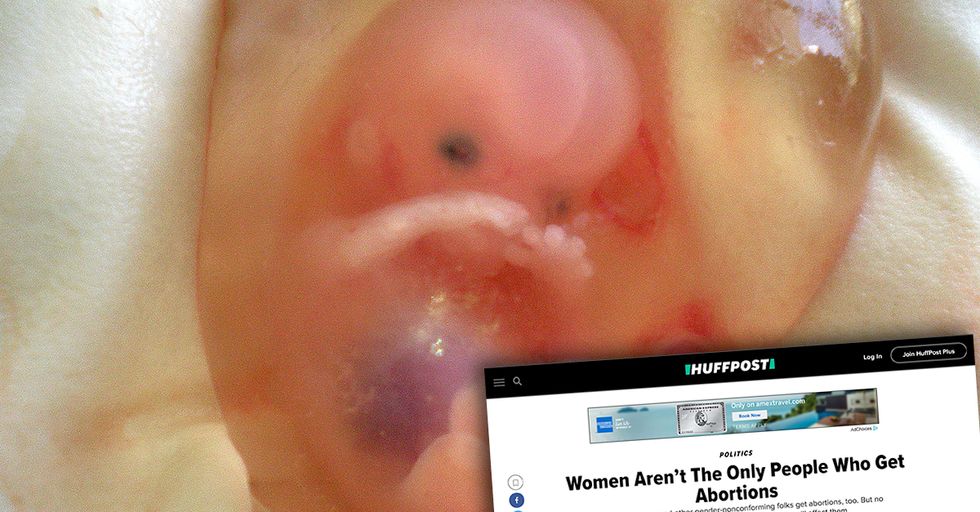 Huffington Post Claims Women Aren't the Only Ones who get Abortions