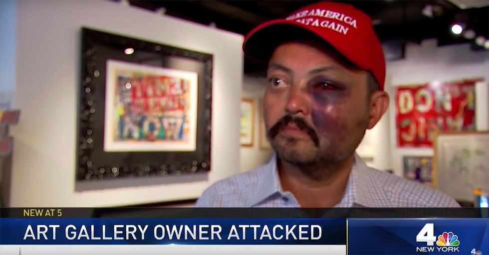 WATCH: NYC Trump Supporter Recounts Being Attacked By Anti-Trump Thugs