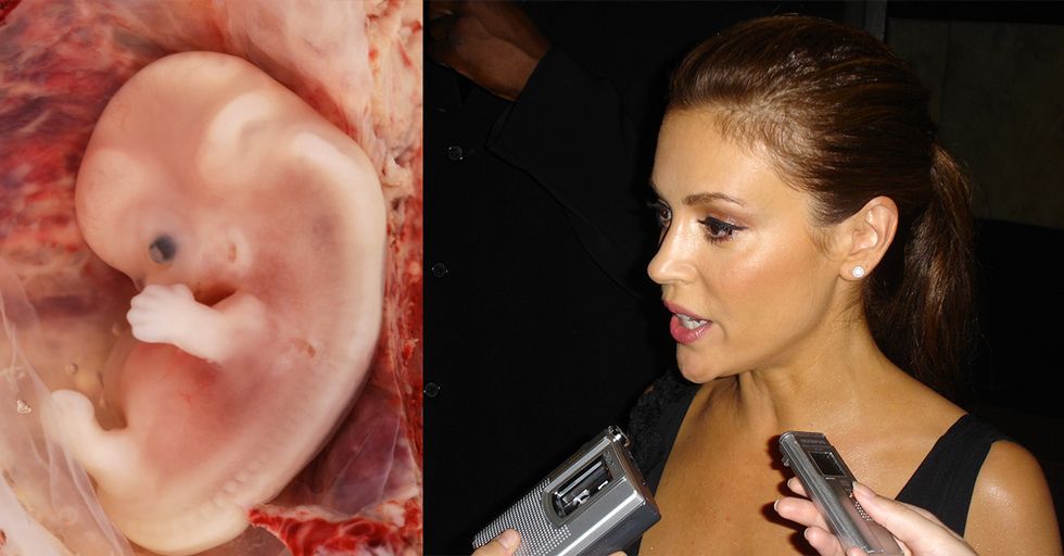 Alyssa Milano Reveals She Had 2 Abortions in 1993. Even Though She Was On Birth Control!