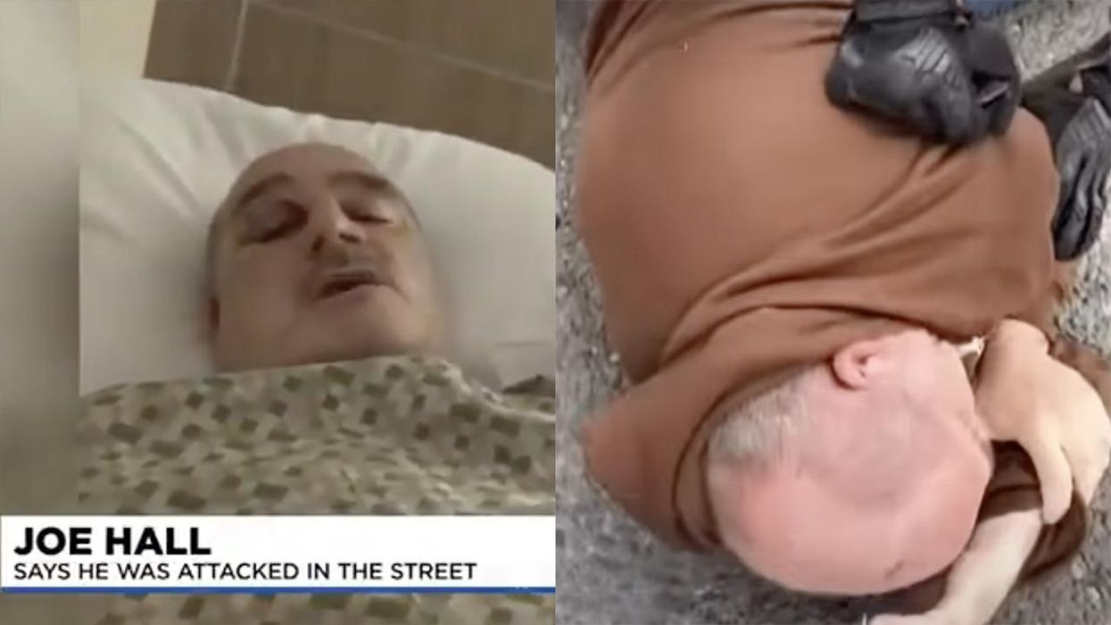 Disabled Marine Assaulted, Hospitalized By Armed Antifa Thugs Speaks Out: Where Were the Police?