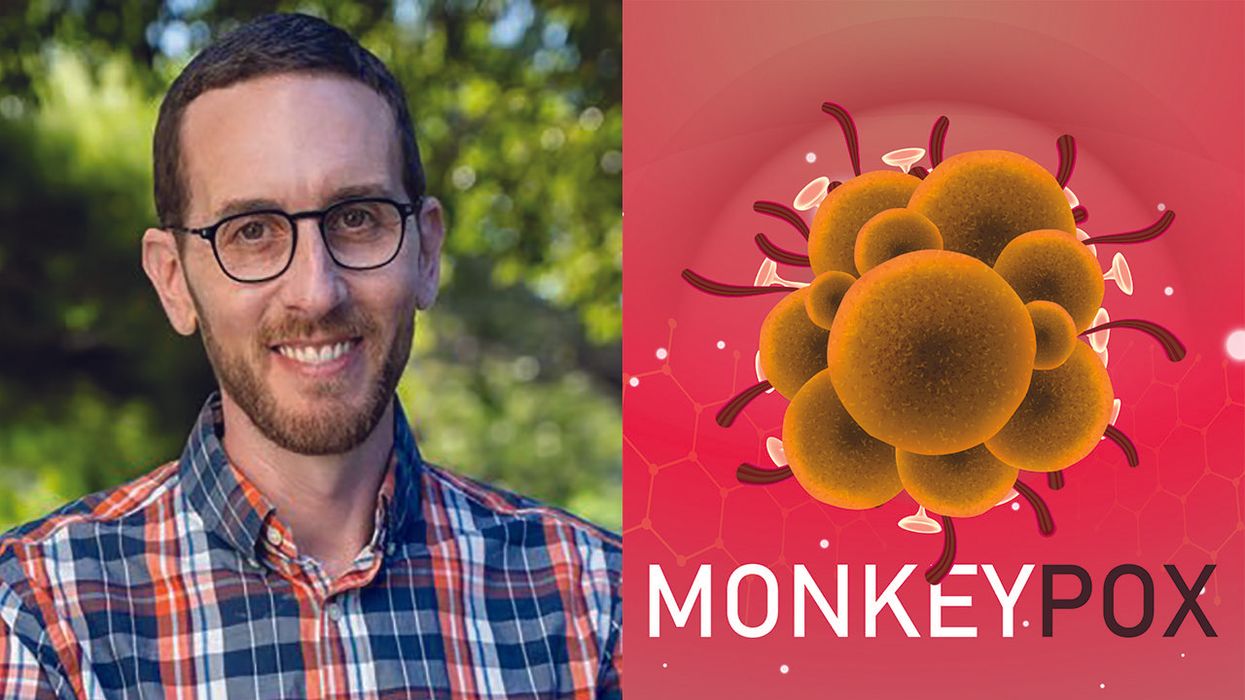 Pro-lockdown, pro-mask Democrat on Monkeypox response: People will make their own decisions about risk levels