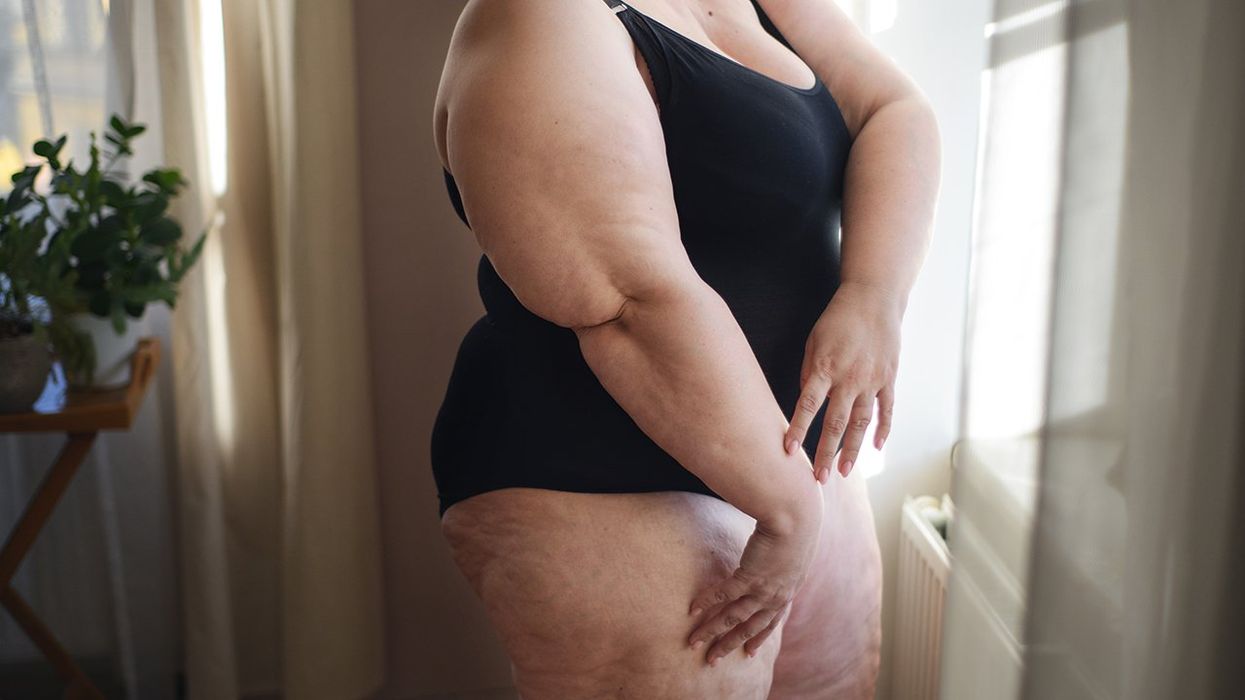 NYC Passes New Law, It's Now Discrimination To Judge Fat People For Being Fat