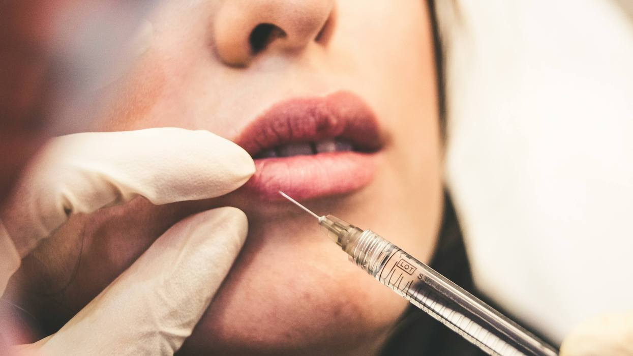 Planned Parenthood's desperate for cash after Trump cut their funding, so they're breaking into the... Botox market?