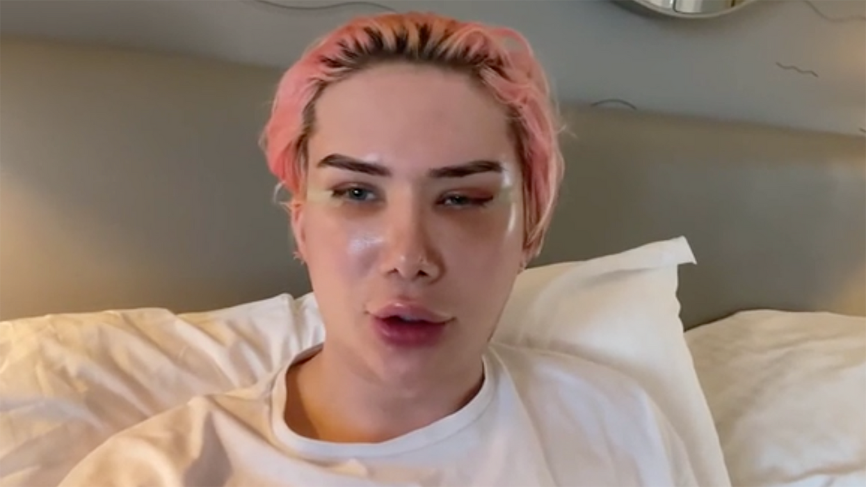 White Influencer Receives Realignment Surgery to Turn Him ... Korean, and I Have Questions