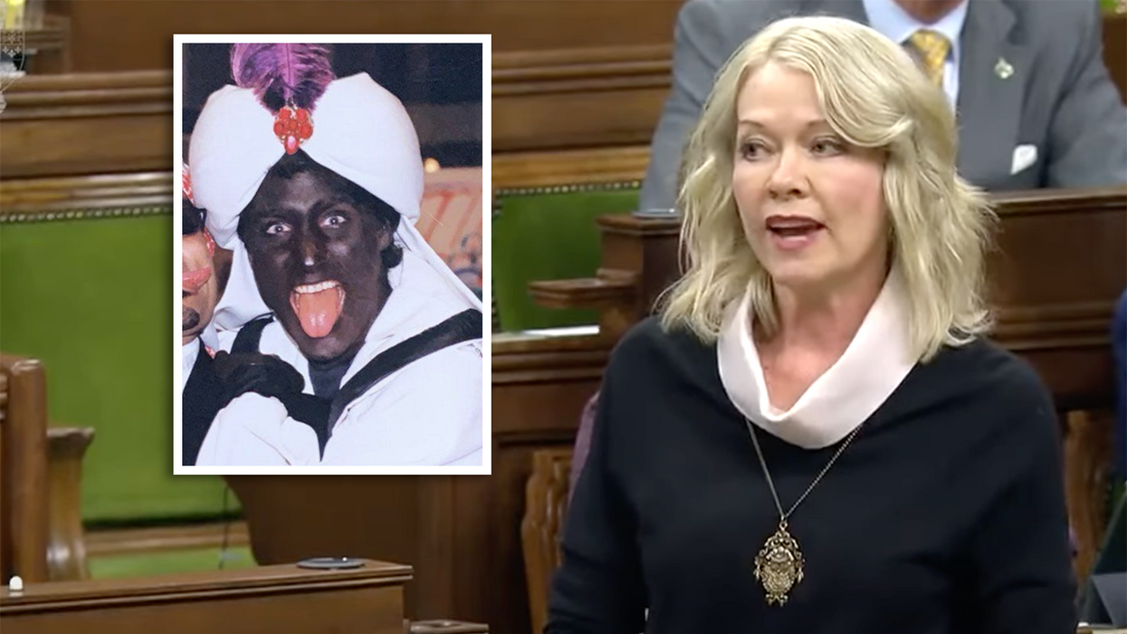 Official Unloads Over Trudeau Calling Freedom Convoy 'Racist': Hey, Remember All That Blackface You Wore?
