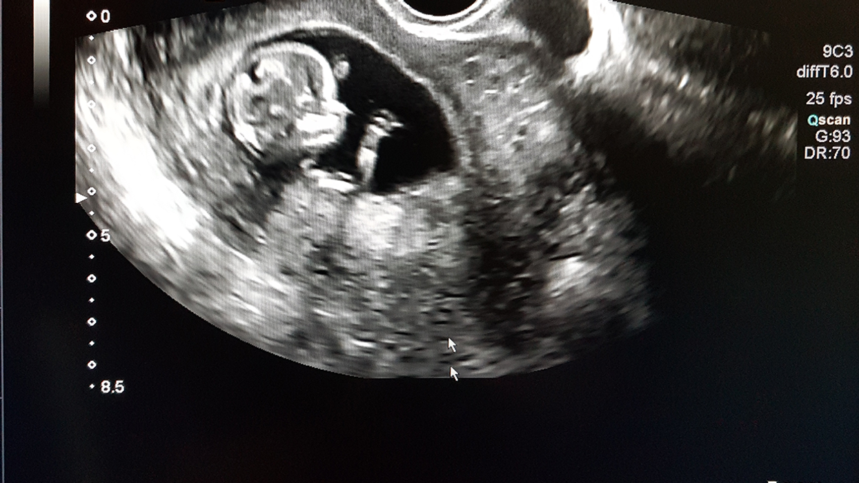 Same Sex Couple Sues Fertility Clinic After Conceiving a Boy, Claims Entire Ordeal 'Just Like Rape'