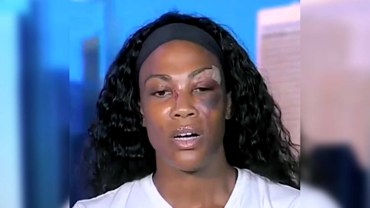 'History Repeats Itself': Olympian Assaulted by Homeless Man on the Crime Infested LA Streets Speaks Out