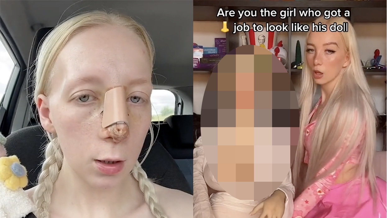 Influencer spends $11k for plastic surgery to look like boyfriend's sex doll because that's the world we live in