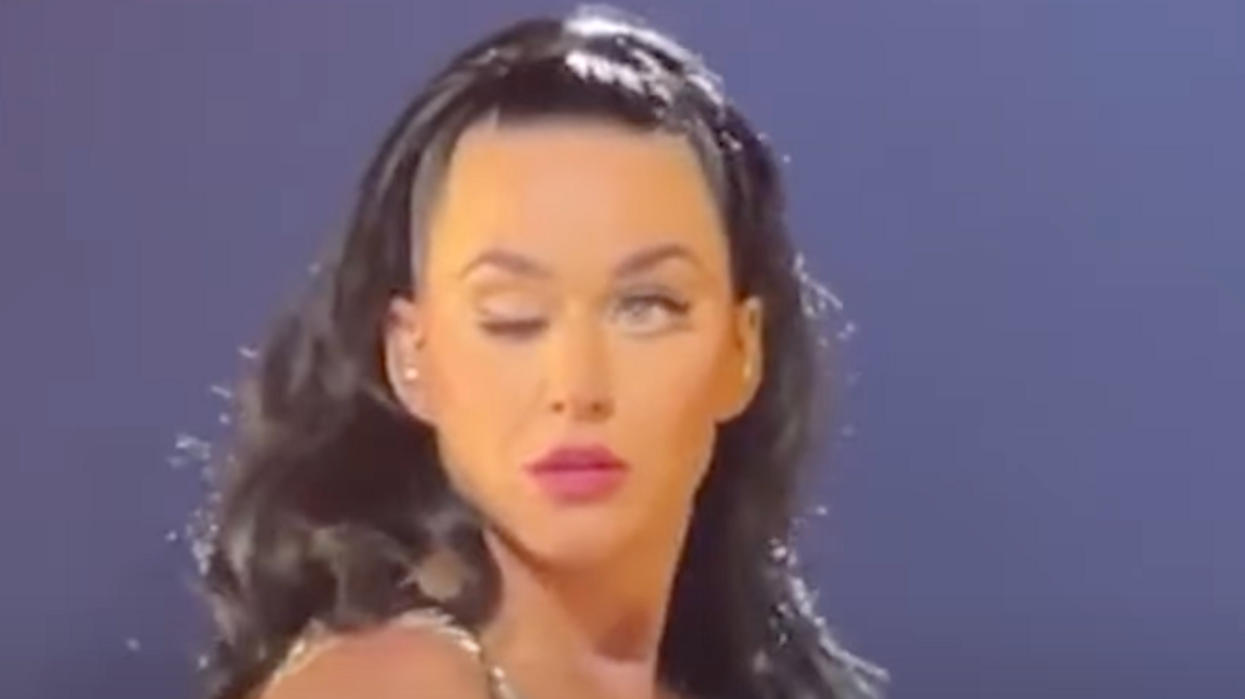 Katy Perry addresses her gross looking wonk eye on Twitter