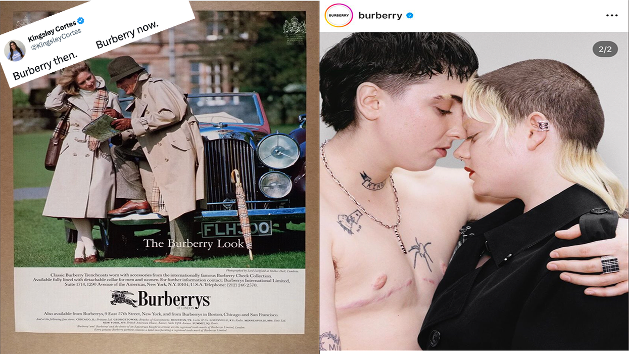 New Burberry ad features a - person - showing off their double mastectomy scars