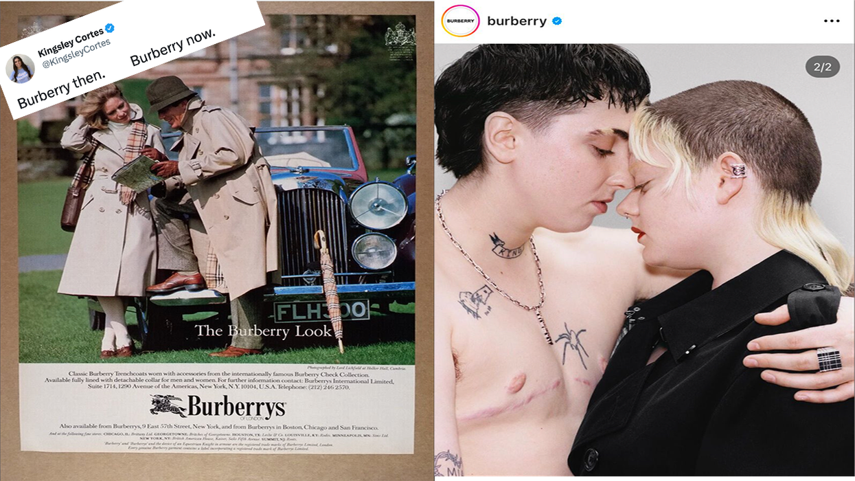 New Burberry ad features a - person - showing off their double mastectomy scars