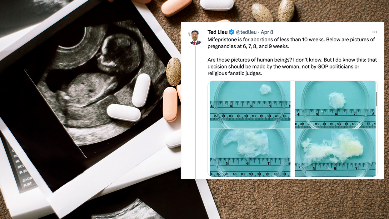Democrat Congressman's Tweet Gets Fact-Checked Into Oblivion Over What An Early Pregnancy Looks Like