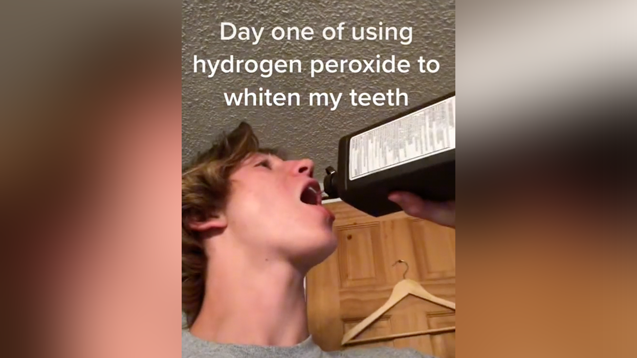 Dentists Had To Warn Against 'Catastrophic' DIY TikTok Trends Because They Can Literally Kill Your Teeth