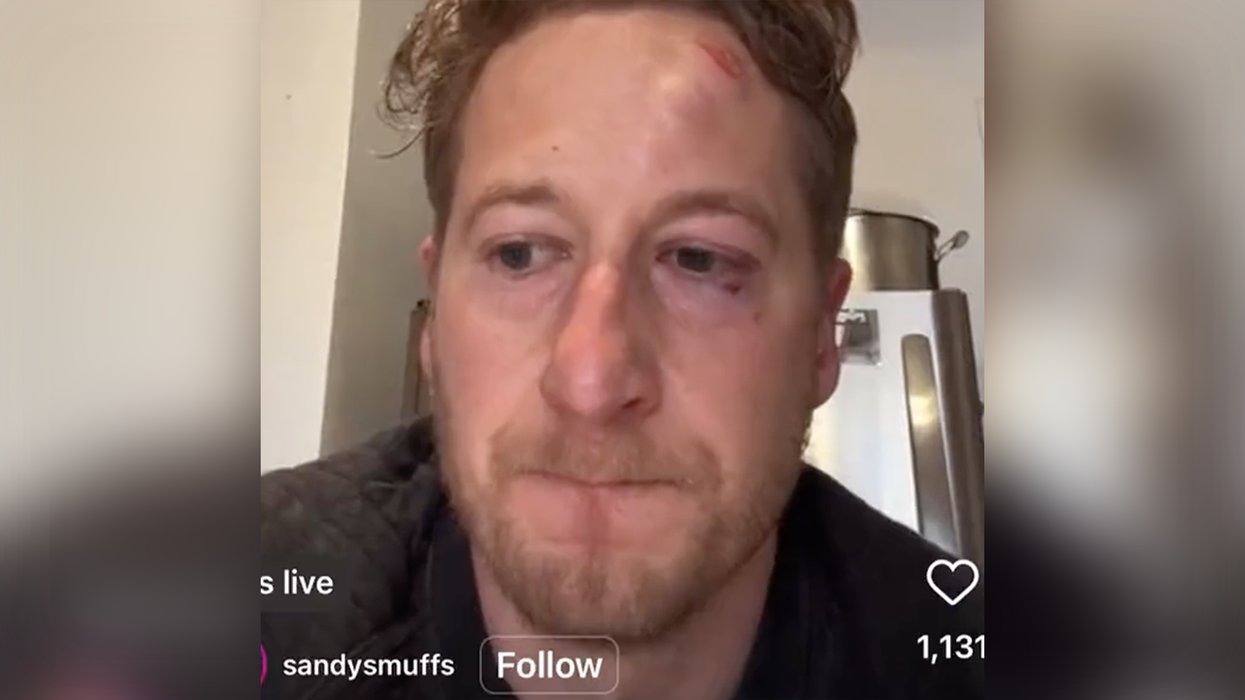 Shop owner melts down after getting punched in the face by a guy peeing in the street: "I'm fed up with this city"