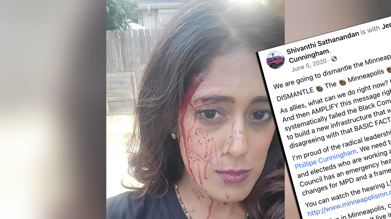 Anti-cop Democrat calls for tougher crime laws after being assaulted, doesn't appreciate irony