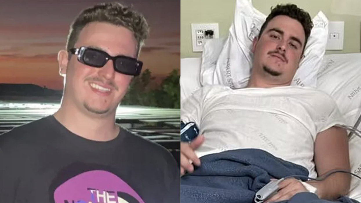 Student Parties With A Bullet In His Brain, Took Him Four Days Before Realizing He Had Been Shot In The Head