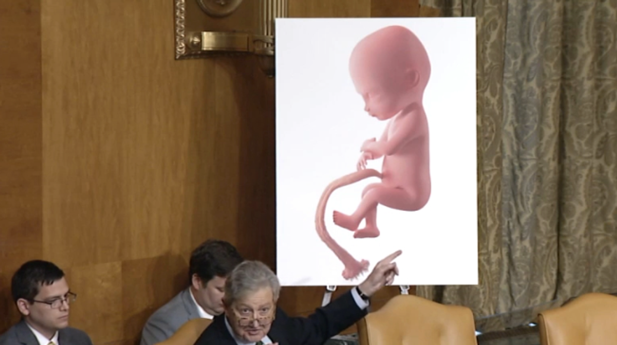 Watch: Pro-Abortion Professor forced to admit abortion kills a baby after GOP Senator highlights the horrifying details