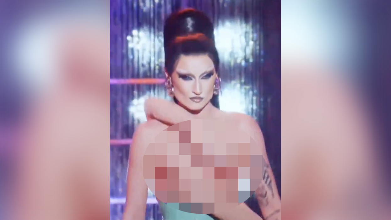 RuPaul’s Drag Race performer shows off disgusting double mastectomy "costume," because trans joy or something