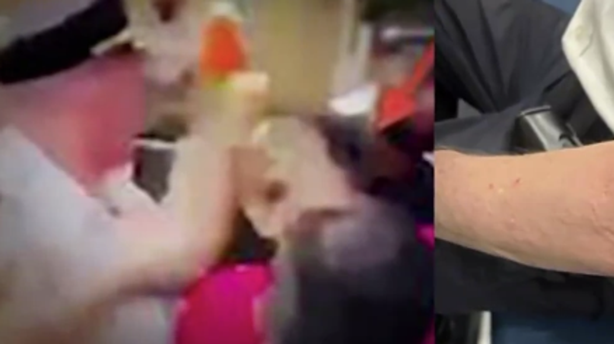 Democrat councilwoman goes bananas, BITES police officer at protest