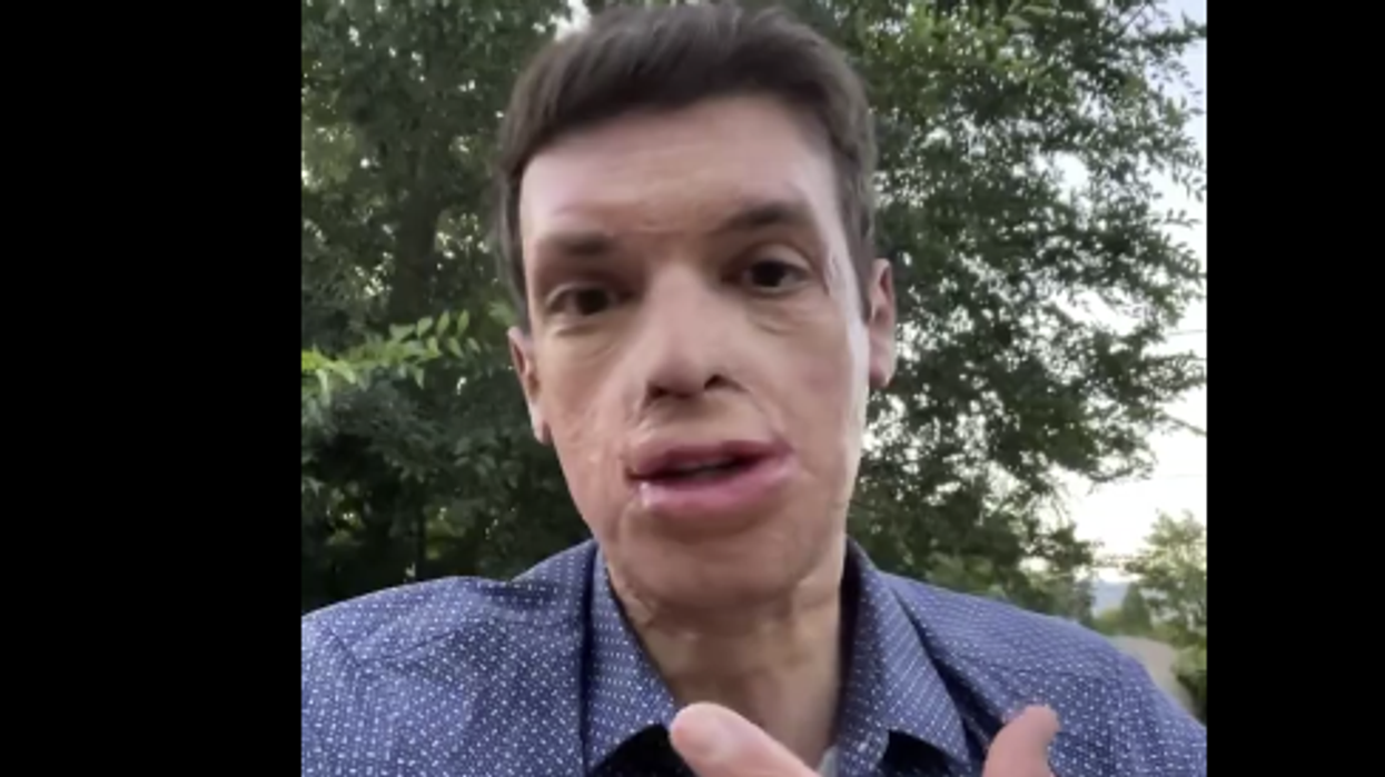 Democrats attack combat wounded patriot as "weird," watch how he responds