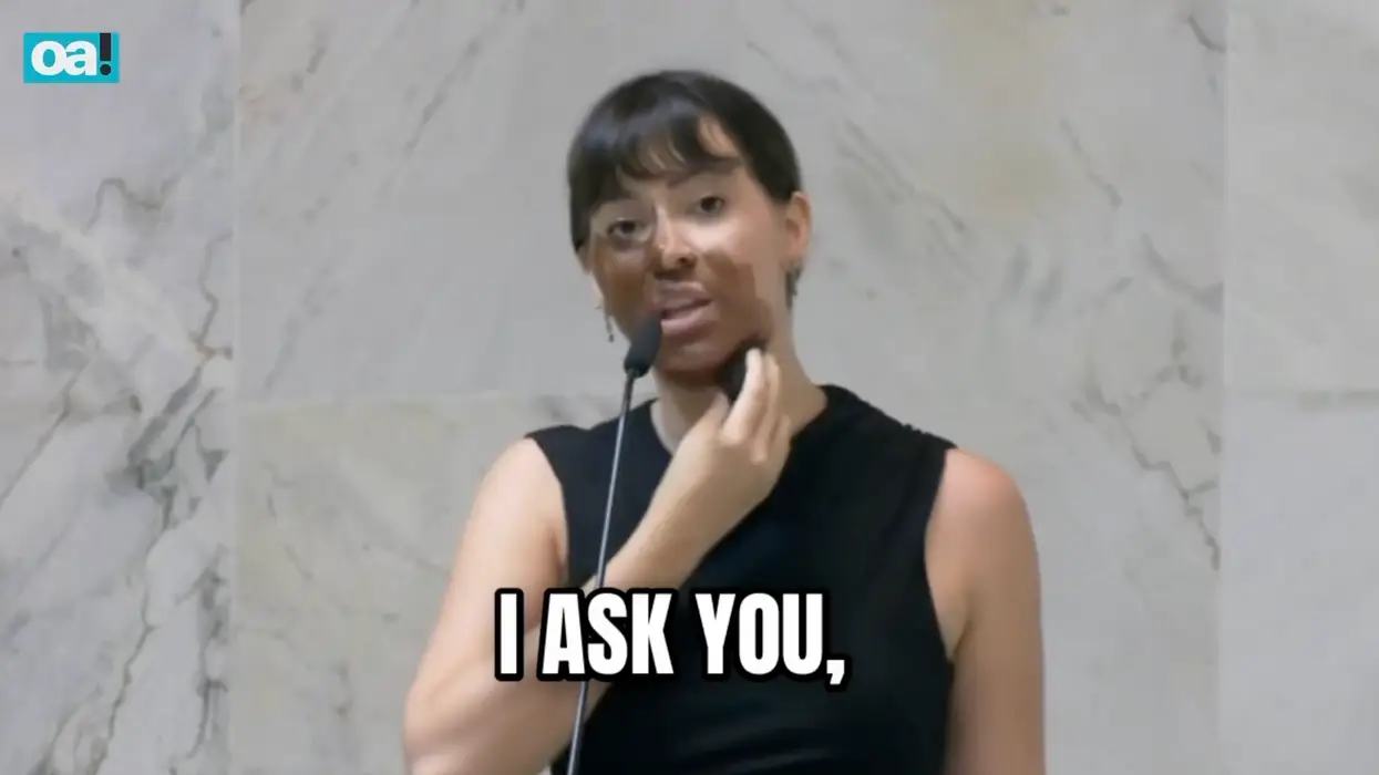 Lawmaker goes blackface to make a point against trans activism